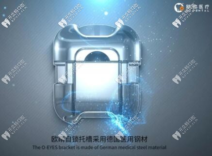 歐睛(O-Eyes)自鎖托槽圖片