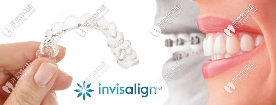 想在太倉戴隱適美隱形牙套的看這里,這個收費價格愛了嗎