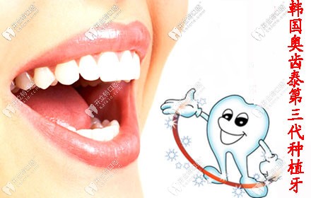 韓國奧齒泰種植牙價格