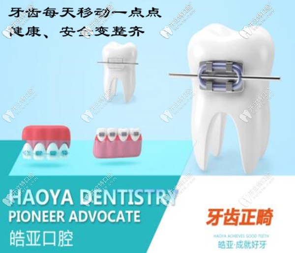 蘭州皓亞口腔牙齒矯正價格