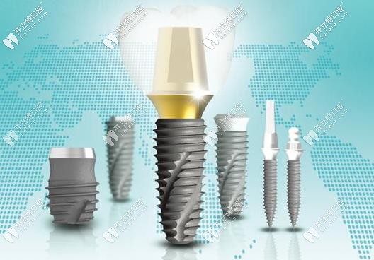 快戳本文了解關(guān)于韓國種植體中的伊諾inno種植牙的優(yōu)缺點(diǎn)吧