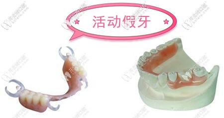 福州牙科鑲假牙收費(fèi)價(jià)目表