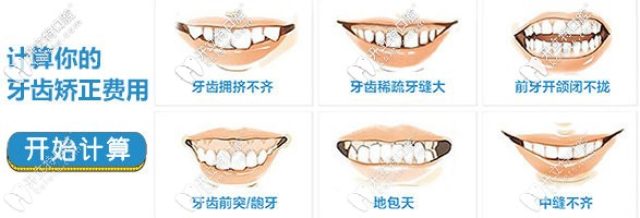 牙齒矯正的價(jià)格