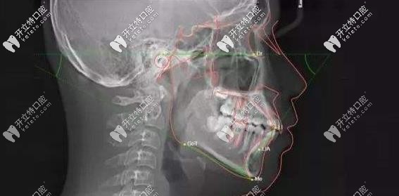口腔影像AI分析評(píng)估系統(tǒng)