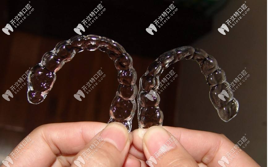 隱形牙套矯正 隱形牙套矯正