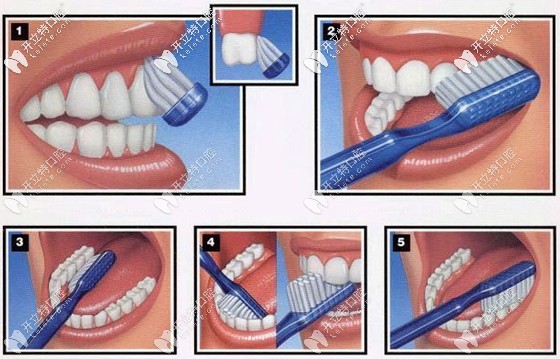 <!--<i data=20240703-sp></i>-->醫(yī)生講解巴氏刷牙法 <!--<i data=20240703-sp></i>-->醫(yī)生講解巴氏刷牙法