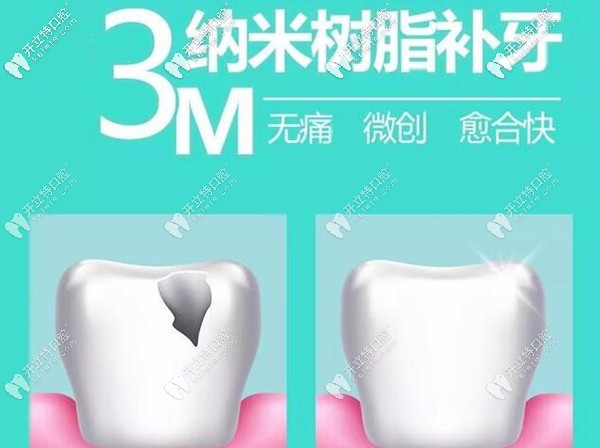 母親節(jié)西安美奧口腔樹脂補(bǔ)牙免費(fèi)