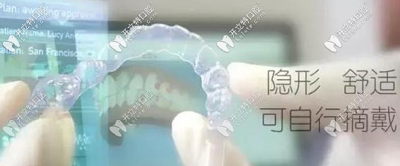 盤它！2025年深圳牙套價格出爐,隱形牙齒矯正1萬多就搞定啦