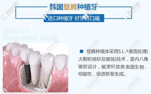 福州維樂口腔韓國(guó)登騰種植牙
