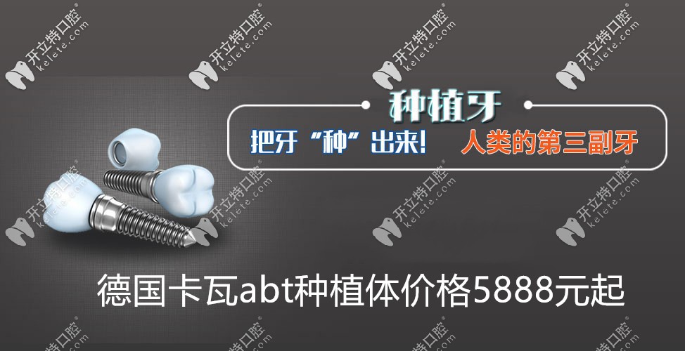 德國卡瓦abt種植牙價(jià)格