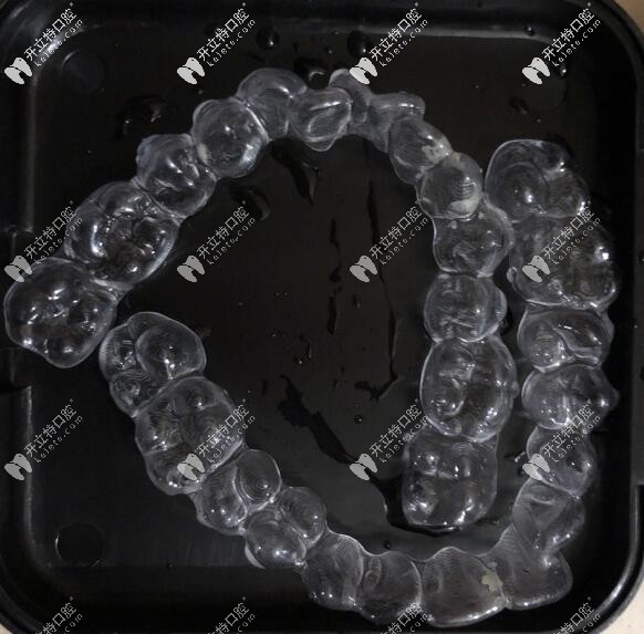 時代天使隱形牙套