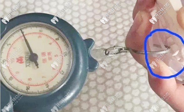 網(wǎng)購牙套引起的危害