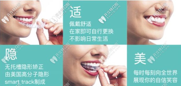 美國進(jìn)口隱適美隱形矯正 美國進(jìn)口隱適美隱形矯正