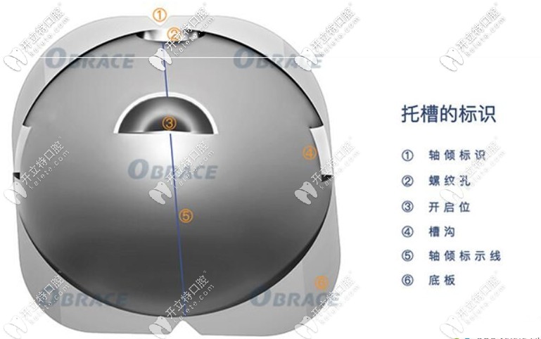 OBrace球面自鎖托槽技術(shù) OBrace球面自鎖托槽技術(shù)