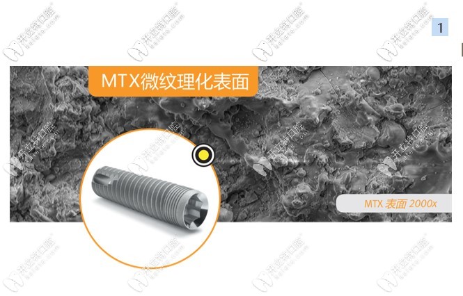 美國zimmer種植體特殊的表面處理