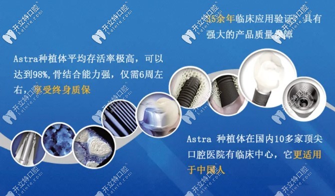 長沙利爾口腔瑞士Astra種植牙優(yōu)勢