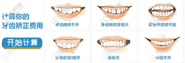 想在洛陽做隱形矯正的朋友速來關(guān)注隱適美隱形牙套價格吧
