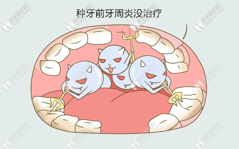 種牙后牙床全爛了是種植前牙周有炎癥沒有進(jìn)行控制