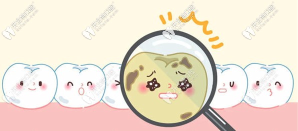 兒童千萬不要補(bǔ)牙時(shí)謠言