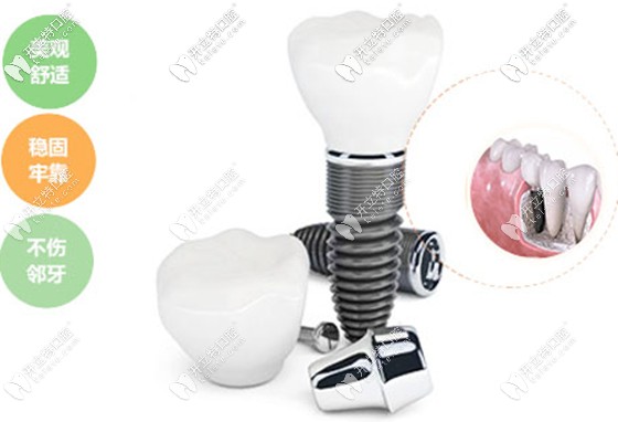 美國皓圣hiossen和韓國奧齒泰補貼價超優(yōu)惠