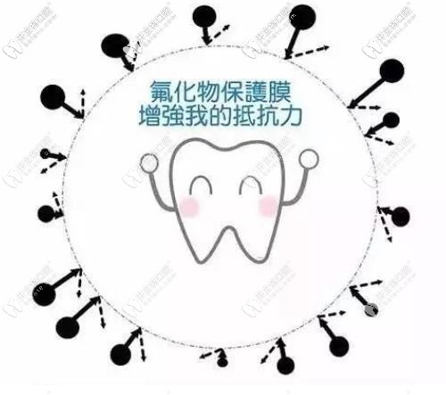 兒童牙齒涂氟好處