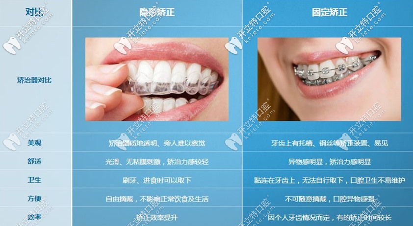 剛牙套和隱形牙套的區(qū)別
