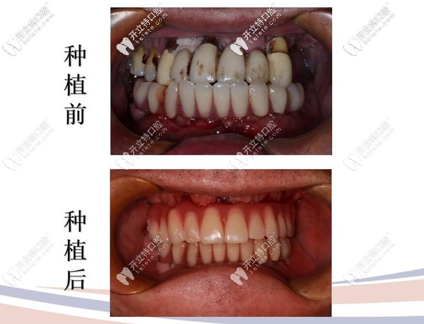 即刻修復(fù)案例