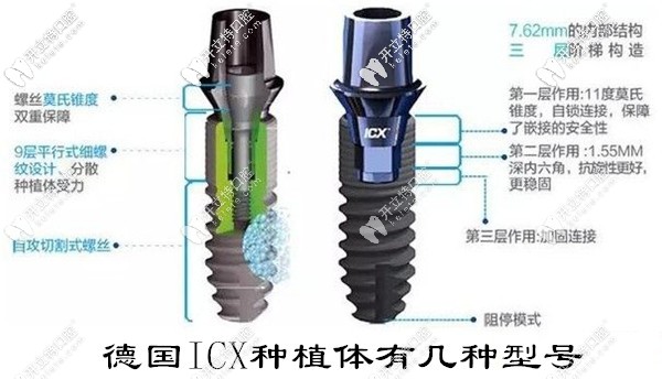 德國ICX種植體的規(guī)格