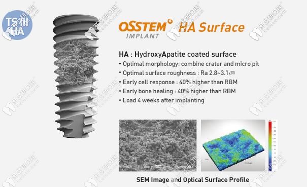 奧齒泰種植體的表面設(shè)計(jì)