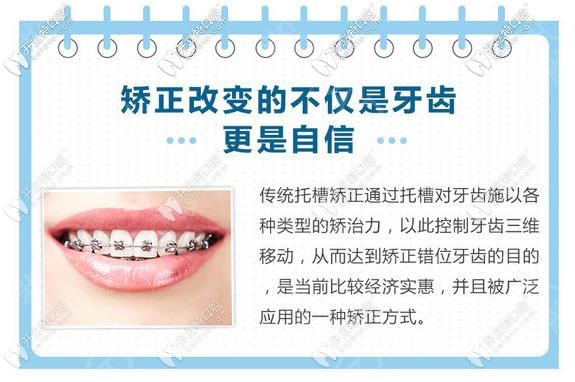 傳統的鋼絲矯正優(yōu)勢