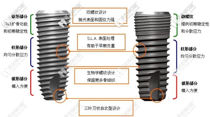 種植體的優(yōu)勢