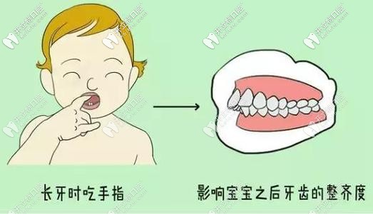 導(dǎo)致錯頜畸形的緣故 導(dǎo)致錯頜畸形的緣故