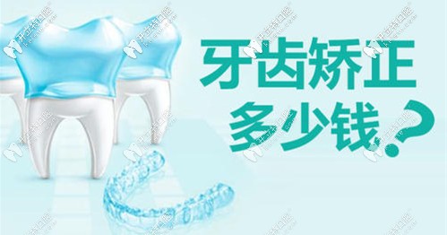 做牙齒矯正需要多少錢 做牙齒矯正需要多少錢