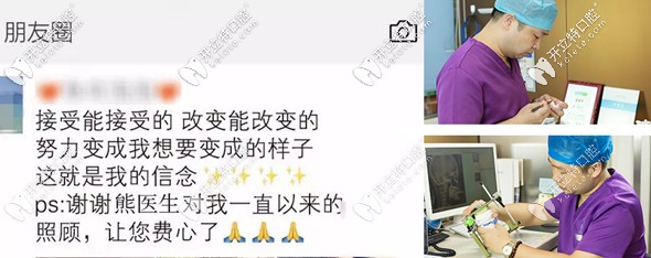 在廣州圣貝牙科花兩萬多元做矯正的效果