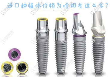 揭開(kāi)真相：主流的進(jìn)口種植牙價(jià)格為什么差距那么大