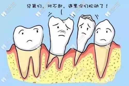 牙周病導致牙齒松動 牙周病導致牙齒松動
