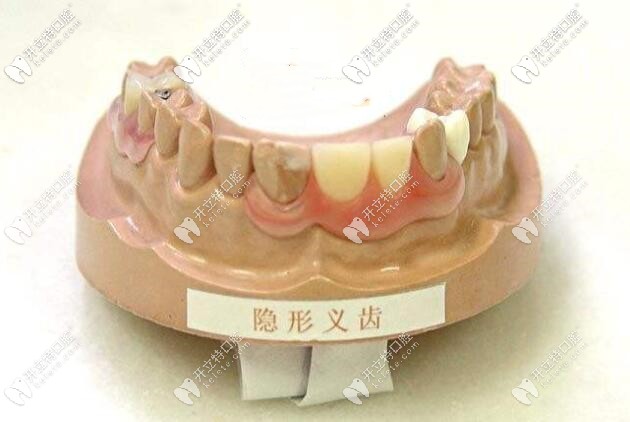 劉詩奇醫(yī)生大講堂——隱形義齒和鋼托哪個好