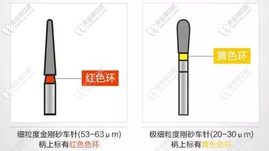 車(chē)針的各種分類(lèi)