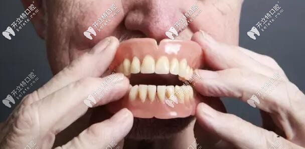 活動(dòng)假牙圖片