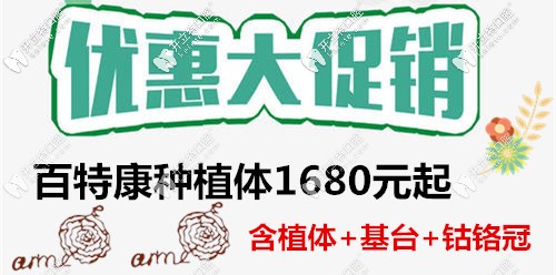 百特康種植體的價(jià)格