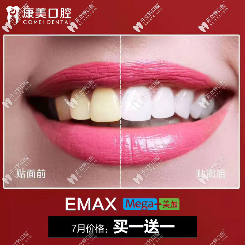 樹(shù)脂貼面買(mǎi)一贈(zèng)一 樹(shù)脂貼面買(mǎi)一贈(zèng)一