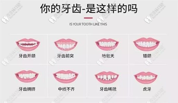 各種畸形的牙齒圖片 各種畸形的牙齒圖片