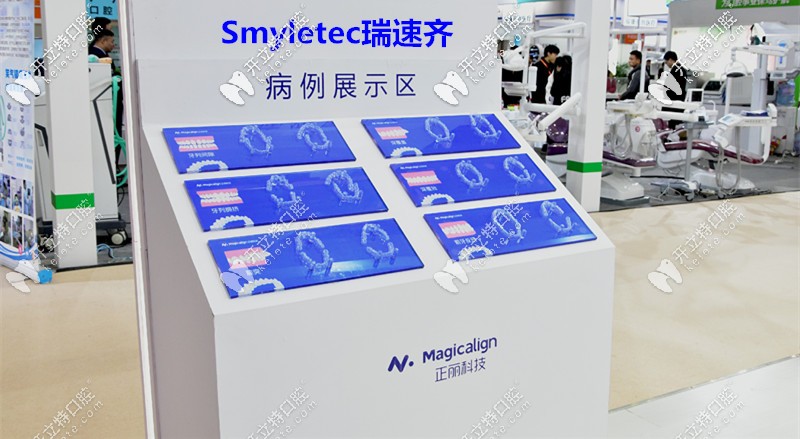 瑞速齊隱形牙套的病例展示