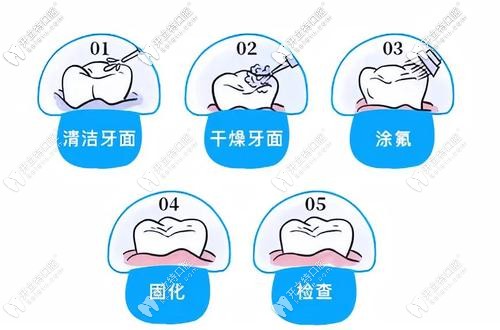 涂氟要經(jīng)過(guò)哪些步驟