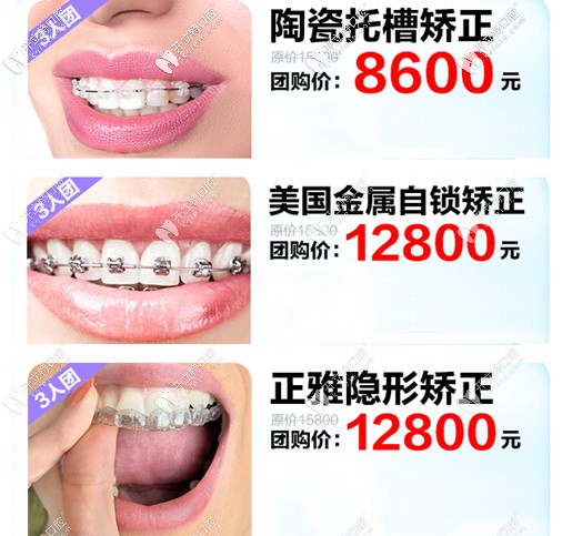 廣州家庭醫(yī)生口腔的正畸拼團(tuán)價(jià)介紹