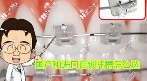 國產(chǎn)和進(jìn)口自鎖托槽區(qū)別