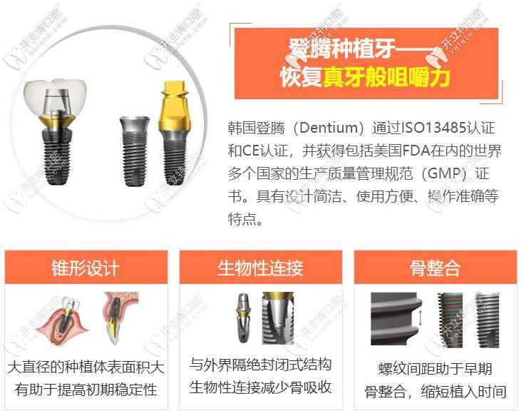 韓國登騰種植牙質(zhì)量怎么樣