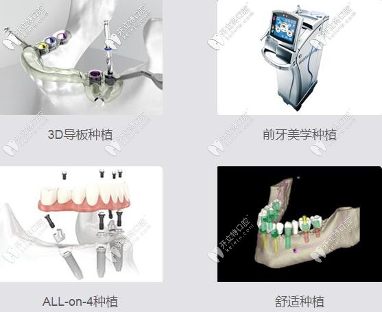 昆明美奧口腔4大種植技術(shù)
