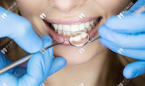 張寧醫(yī)生分享牙周病預(yù)防小知識(shí) 張寧醫(yī)生分享牙周病預(yù)防小知識(shí)