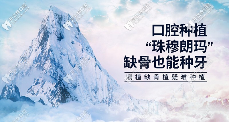 VIIV穿顴穿翼種植技術(shù)